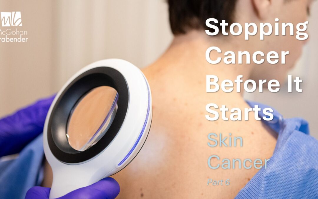 Stopping Cancer Before It Starts: Skin Cancer